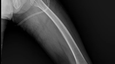 Medical Imaging DICOM Project featured image